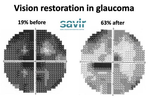 ZOOM Presentation: "New Methods of Vision Restoration" by Prof. Dr. Ph.D. Bernhard Sabel
